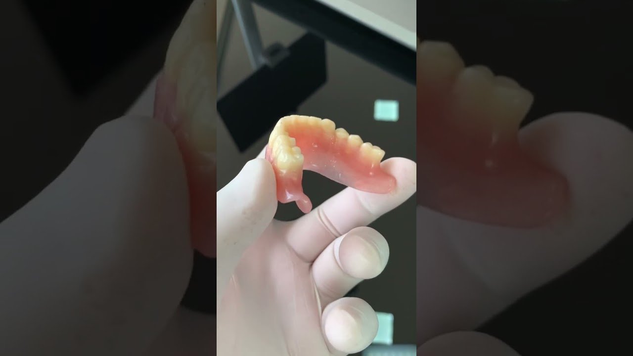 Top 55 Comidas Ideales para Dentaduras Sensibles: Guía para Adultos Mayores